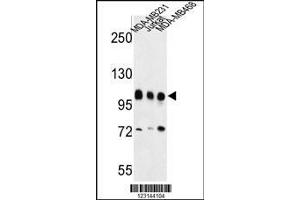 Image no. 2 for anti-Enhancer of Zeste Homolog 2 (EZH2) (AA 1-296), (N-Term) antibody (ABIN650707)
