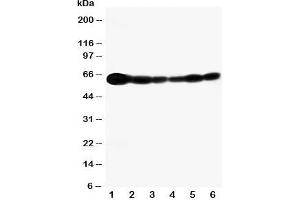 Image no. 7 for anti-SHC (Src Homology 2 Domain Containing) Transforming Protein 1 (SHC1) (C-Term) antibody (ABIN3032555)