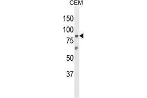 Image no. 2 for anti-Zinc Finger Protein 160 (ZNF160) (AA 150-179), (N-Term) antibody (ABIN955682)