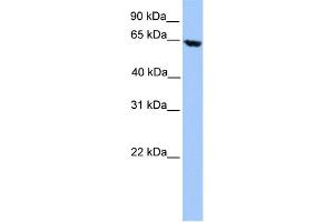 anti-Acyl-CoA Dehydrogenase, Very Long Chain (ACADVL) (N-Term) antibody