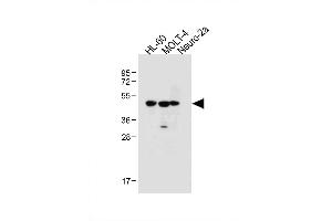 Image no. 3 for anti-Bleomycin Hydrolase (BLMH) (AA 212-242) antibody (ABIN1881113)