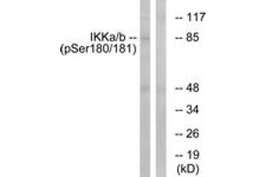 Western blot analysis of extracts from HepG2 cells treated with TNF 20ng/ml 5', using IKK-alpha/beta (Phospho-Ser180/181) Antibody.