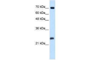 Image no. 2 for anti-SERTA Domain Containing 1 (SERTAD1) (N-Term) antibody (ABIN2775717)