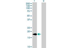 Image no. 1 for anti-ADP-Ribosylation Factor-Like 2 Binding Protein (ARL2BP) (AA 1-163) antibody (ABIN525268)