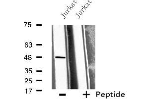 Image no. 1 for anti-Bone Morphogenetic Protein 10 (BMP10) antibody (ABIN6256960)