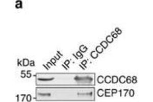 Image no. 3 for anti-Coiled-Coil Domain Containing 68 (CCDC68) (Center) antibody (ABIN2856453)