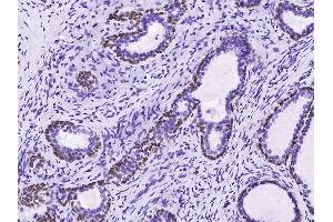 Image no. 1 for anti-Tumor Protein P63 (TP63) (C-Term) antibody (ABIN2682710)