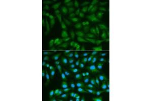 Image no. 2 for anti-Sorbitol Dehydrogenase (SORD) antibody (ABIN3022962)