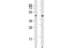 Image no. 1 for anti-Acetyl-CoA Acetyltransferase 1 (ACAT1) (AA 296-329) antibody (ABIN5647681)