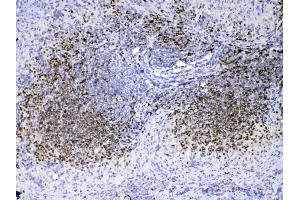 Image no. 3 for anti-Paired Box 5 (PAX5) (AA 217-282) antibody (ABIN5692907)