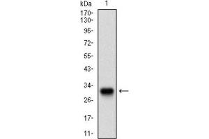Image no. 5 for anti-Twist Homolog 1 (Drosophila) (TWIST1) (AA 9-74) antibody (ABIN1842915)