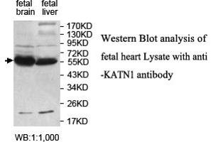 Image no. 1 for anti-Katanin P60 (ATPase Containing) Subunit A 1 (KATNA1) antibody (ABIN6584238)