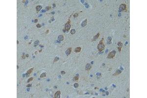 Image no. 2 for anti-Contactin Associated Protein-Like 5 (CNTNAP5) (AA 25-302) antibody (ABIN5013395)