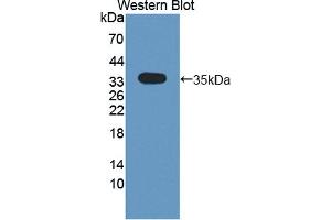 Image no. 2 for anti-Cytokine Receptor-Like Factor 1 (CRLF1) (AA 110-408) antibody (ABIN1867389)