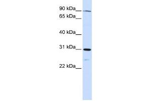 Image no. 1 for anti-LON Peptidase N-terminal Domain and Ring Finger 3 (LONRF3) (N-Term) antibody (ABIN631381)