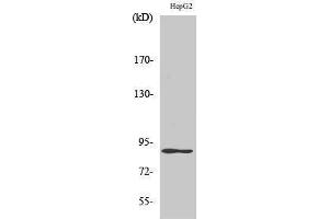 Image no. 1 for anti-Dual-Specificity tyrosine-(Y)-phosphorylation Regulated Kinase 1A (DYRK1A) (N-Term) antibody (ABIN3184371)