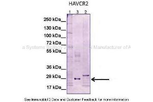 Image no. 2 for anti-Hepatitis A Virus Cellular Receptor 2 (TIM 3) (N-Term) antibody (ABIN2782255)