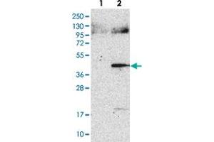 anti-Aspartate beta-Hydroxylase Domain Containing 2 (ASPHD2) antibody