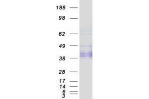 Image no. 1 for Osteoglycin (OGN) (Transcript Variant 1) protein (Myc-DYKDDDDK Tag) (ABIN2726015)