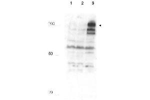 Western blot using  Affinity Purified anti-APC1 pS355 antibody shows detection of a band ~215 kDa corresponding to phosphorylated human APC1 (arrowhead).