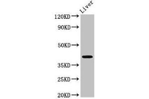 MAB21L2 anticorps  (AA 1-300)