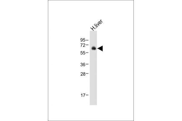 UGT2B15 antibody  (AA 156-185)