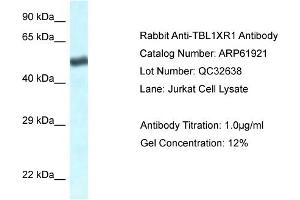 Image no. 1 for anti-Transducin (Beta)-Like 1 X-Linked Receptor 1 (TBL1XR1) (C-Term) antibody (ABIN2788949)