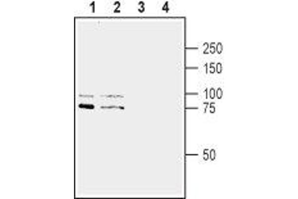 anti-SLIT and NTRK-Like Family, Member 1 (SLITRK1) (AA 383-397), (Extracellular), (N-Term) antibody