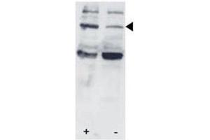 Image no. 4 for anti-Signal Transducer and Activator of Transcription 3 (Acute-Phase Response Factor) (STAT3) (pSer727) antibody (ABIN3032570)