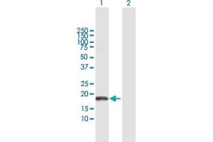 Western Blot analysis of PLA2G16 expression in transfected 293T cell line by PLA2G16 MaxPab polyclonal antibody.