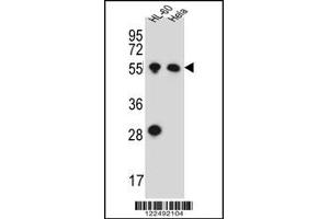 Image no. 2 for anti-Hyaluronan Synthase 2 (HAS2) (Center) antibody (ABIN2438280)