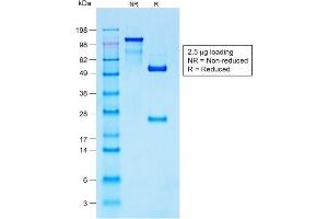 Image no. 1 for anti-S100 Calcium Binding Protein B (S100B) antibody (ABIN6940560)