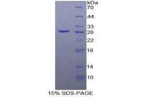 Image no. 1 for Prostaglandin E Receptor 2 (Subtype EP2), 53kDa (PTGER2) (AA 155-355) protein (His tag) (ABIN1879089)