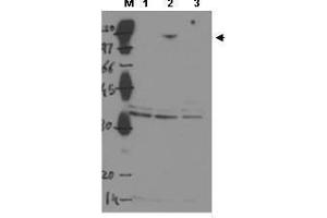 Western blot using  Protein A purified anti-ASPP2 to detect over-expressed ASPP2 in MCF-7 cells (Lane 2, arrowhead).