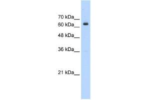 Image no. 1 for anti-BTB (POZ) Domain Containing 14A (BTBD14A) (N-Term) antibody (ABIN2775918)