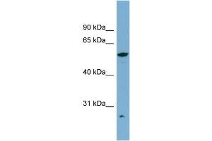 Image no. 2 for anti-Aldehyde Dehydrogenase 3 Family, Member A2 (ALDH3A2) (Middle Region) antibody (ABIN2781792)