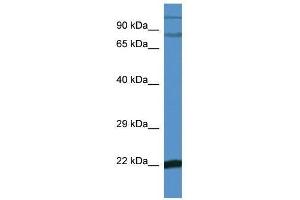 Image no. 1 for anti-Nuclear Factor of kappa Light Polypeptide Gene Enhancer in B-Cells Inhibitor, zeta (NFKBIZ) (C-Term) antibody (ABIN928976)
