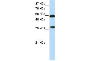 Image no. 2 for anti-AT Rich Interactive Domain 3B (BRIGHT-Like) (ARID3B) (C-Term) antibody (ABIN2780778)