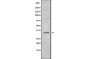 Image no. 1 for anti-Olfactory Receptor, Family 14, Subfamily A, Member 16 (OR14A16) (Internal Region) antibody (ABIN6263885)
