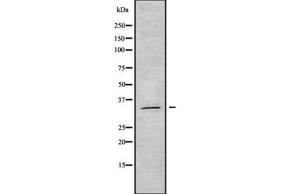 OR14A16 anticorps  (Internal Region)