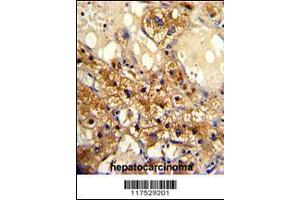 Image no. 3 for anti-Cytochrome P450, Family 20, Subfamily A, Polypeptide 1 (CYP20A1) (AA 364-392), (C-Term) antibody (ABIN391658)