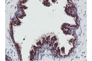 Image no. 3 for anti-Golgi Membrane Protein 1 (GOLM1) antibody (ABIN1498491)