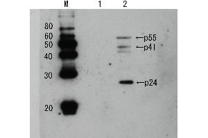 Image no. 1 for anti-Human Immunodeficiency Virus 1 Capsid (HIV-1 p24) (full length) antibody (ABIN2452020)