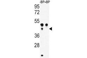 Image no. 3 for anti-Activating Transcription Factor 4 (Tax-Responsive Enhancer Element B67) (ATF4) (AA 220-252) antibody (ABIN3029848)