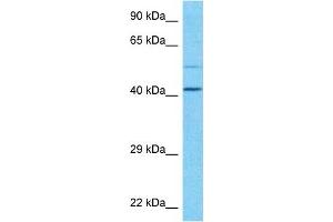 Image no. 1 for anti-Phospholipase D family member 3 (PLD3) (N-Term) antibody (ABIN5517655)