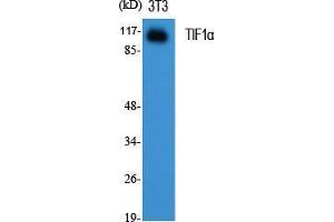 Image no. 2 for anti-Tripartite Motif Containing 24 (TRIM24) (C-Term) antibody (ABIN3187264)