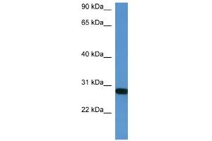 Image no. 1 for anti-Homeobox B1 (HOXB1) (C-Term) antibody (ABIN2777269)