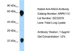 Image no. 1 for anti-Recombination Activating Gene 2 (RAG2) (C-Term) antibody (ABIN2788687)