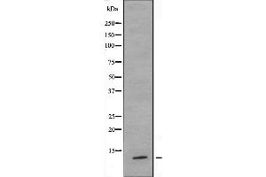 Image no. 2 for anti-Tumor Suppressor Candidate 2 (TUSC2) antibody (ABIN6257655)