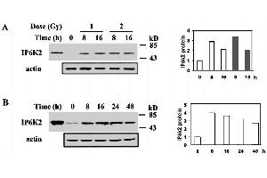 Image no. 1 for anti-Inositol Hexakisphosphate Kinase 2 (IP6K2) antibody (ABIN533904)